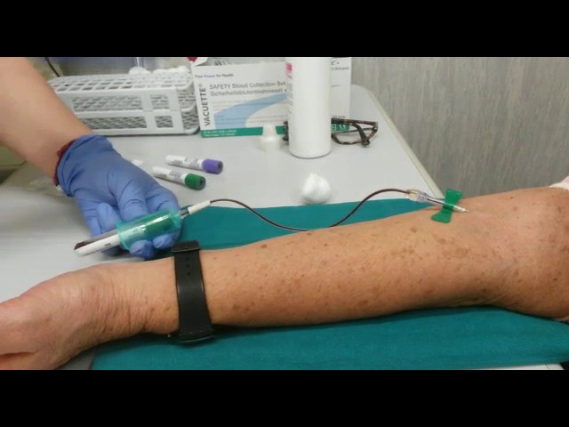 analisi del sangue senza ago dove