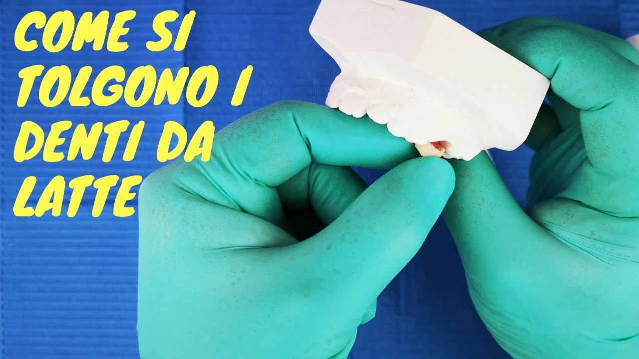come togliere un dente da latte a casa