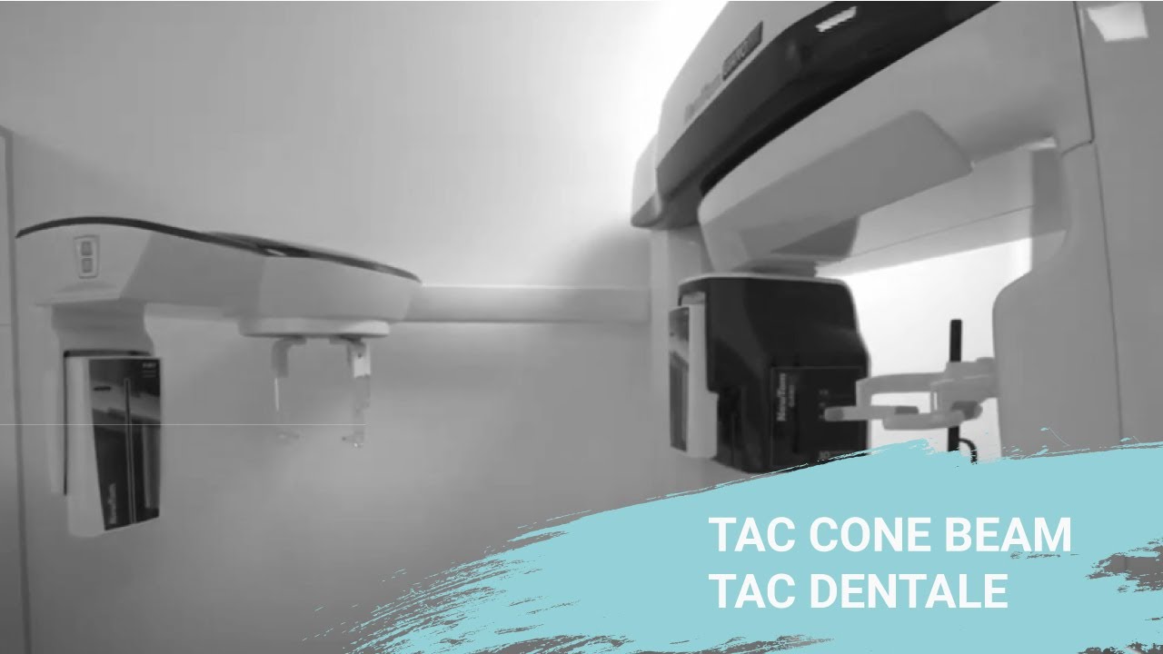 quanto costa una tac ai denti